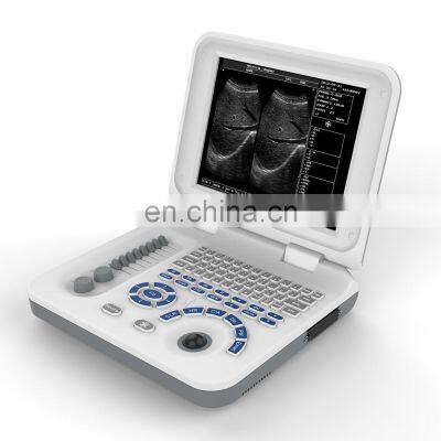 Laptop 10.4inch Elements Medical Ultrasound Machine for Vet Pregnancy