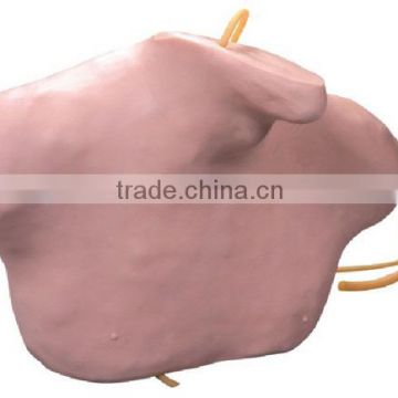 MCT-KC-003 Central Venous Puncture and Catheterization Model