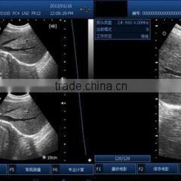 Best Price Pocket Ultrasonic Diagnostic Wireless Ultrasound Probe 10 Years Export Experience Supplier -WBU01 photo-6