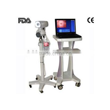 CE & ISO approved Electronic digital video Colposcope on sale