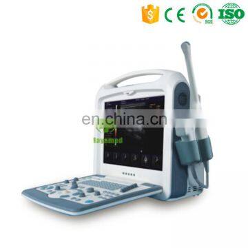 Cheap medical portable color doppler ultrasound elastography ultrasound gel prices