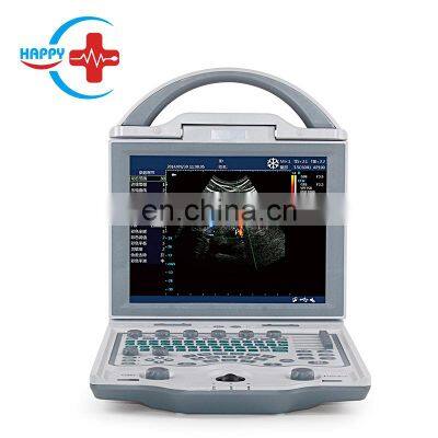 Full Digital Portable Color Doppler Ultrasound equipment with Competitive price