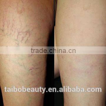 980nm Laser Vascular Removal Machine/skin Rejuvenation Diode Laser 980nm photo-6