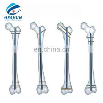 Femoral Interlocking Nail Set