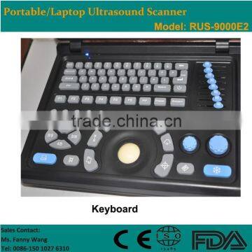 CE Approved Laptop Portable Ultrasound Scanner With 3.5Mhz Multi-frequency Convex Probe RUS-9000E2 photo-2