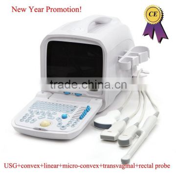 CE approved Portable PC Ultrasound Scanner/Ultrasound Machine with 3.5Mhz multi-frequency convex probe RUS-9000A