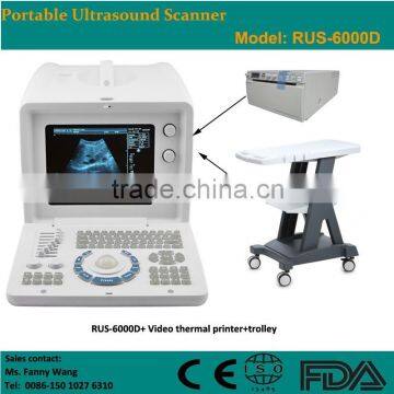 CE Approved Portable B-Mode Ultrasonic/ Ultrasound Scanner With 3.5Mhz Multi-frequency Convex Probe RUS-6000D photo-5