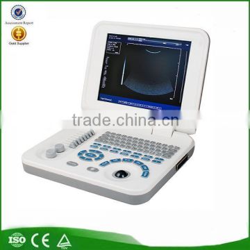 Medical probe full digital 10.4 inch LCD laptop ultrasound machine/system factory pregnancy portable ultrasound scanner