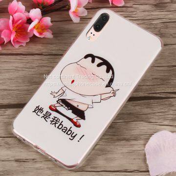 For HUAWEI P20 Cartoon Mobile Phone Shell IMD Flexible Soft TPU Glossy Case for HUAWEI p8 Lite Nova2i photo-2