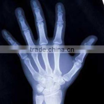 ct scan films of alibaba+cina, medical x-ray film of alibaba supplier