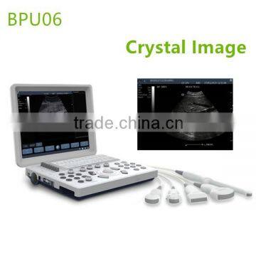 Excellent Laptop Ultrasound Machine for sale- BPU06