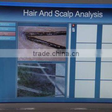 Laser Hair Growth Therapy / Hair Restoration Laser Solution Machine China Manufacturers photo-3