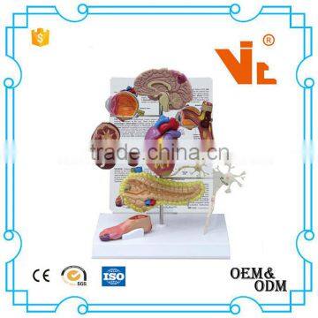 V-AM034 Type II Diabetes Model Set