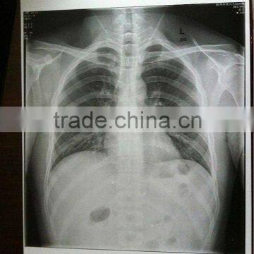 100 microns transparent film,Konida Medical laser printing film