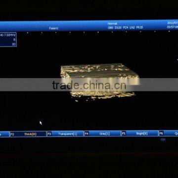 2016 New Laptop Ultrasound Machine / Scanner PC Platform With CE ISO Certification photo-4