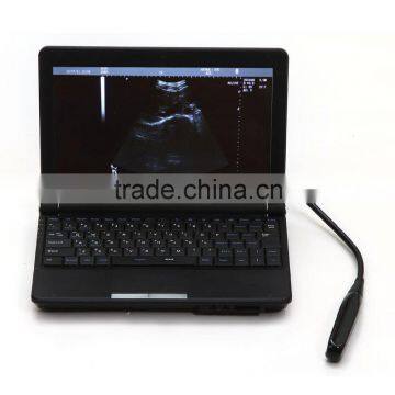 Laptop Veterinar Ultrasound Machine With Low Price photo-2
