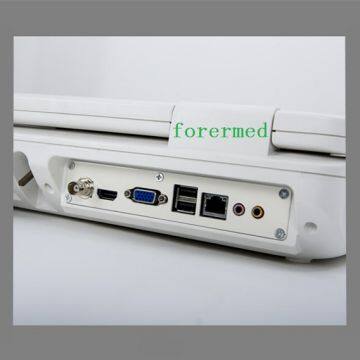 3D / 4D Digital Ultrasound Machine /scanner Color Doppler photo-4