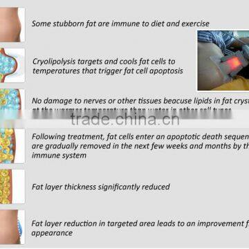Cryolipolysis Slimming Machine/fat Body Slimming Freezing Cryolipolysis/cryolipolysis Machine Body Shaping photo-5
