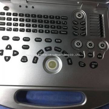 3D Laptop Color Doppler Ultrasound Portable Scanner Diagnostic Equipment photo-4