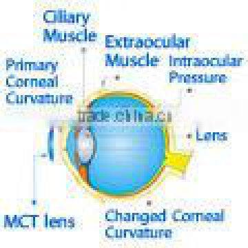 Hard lens For low myopia/MCT lenses/MCT Technology