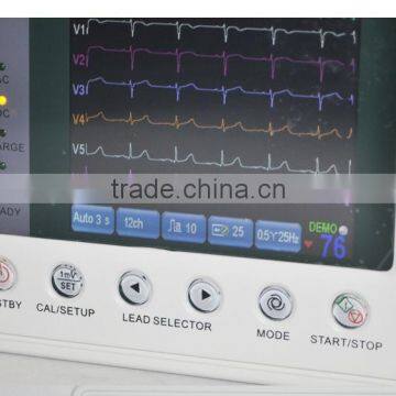 ECG Machine Digital 3 Channel Color Electrocardiograph EKG-903A3 photo-3