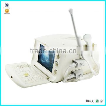 2016 Hospital CE Approved Digital Portable Style Abdominal Ultrasound Machine/Scanner For Pregnancy with Cheap Price-Shelly