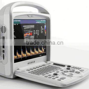 3d Color Doppler Ultrasound Scanner Portable With Optional Transducers photo-2