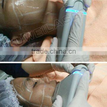 2016 New Product Super Hifu Face Lift Machine/4mhz Big Intensity photo-6