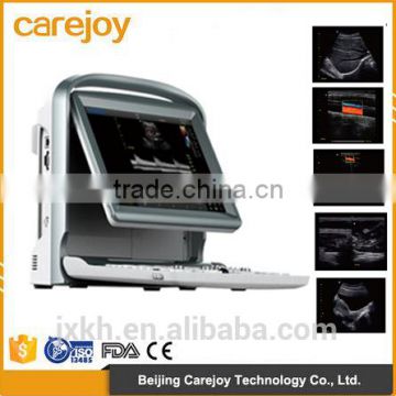 Portable ultrasound scanner Color doppler ultrasound system