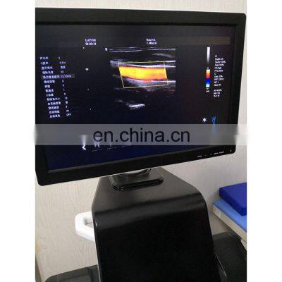 2020 Hot Sale Popular CE Certificate 4D Trolley Color Doppler Ultrasound Machine photo-2