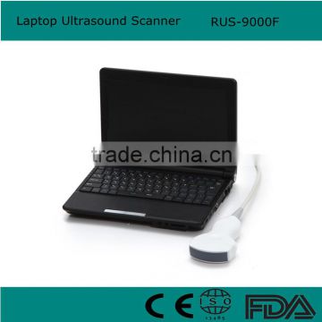 Laptop Ultrasound Machine / Scanner 10 inch monitor RUS-9000F manufacturer