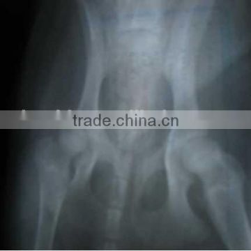 medical x-ray film of alibaba+cina, x-ray blue film of alibaba supplier