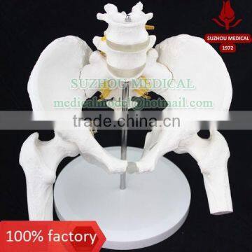 Model of pelvis with 4th and 5th lumbar vertebrea and femur heads                        
                                                Quality Choice