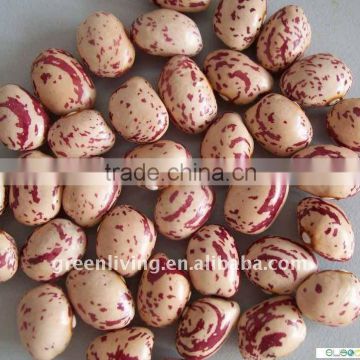 2011 light speckled kidney beans' price