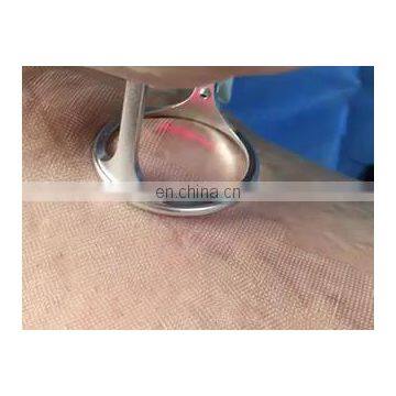 small Tattoo Removal scars remover nd-yag laser