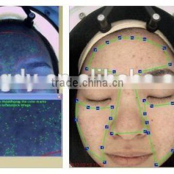 Skin Analyzer and Quantum Resonance Magnetic Analyzer Supplier photo-5