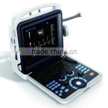 2015 Hot Selling 4D Real Time Color Doppler with CE ISO