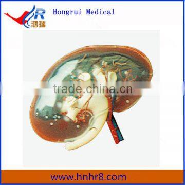 High Quality Transparent Renal Segment Anatomical Model