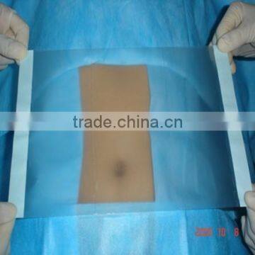 Transparent PU surgical film