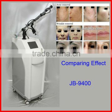 10600nm 2013 Newest Fractional CO2 Laser Wrinkle/Age Spot/Striae Gravidarum/Stretch Mark Removal Beauty Equipment Mole Removal