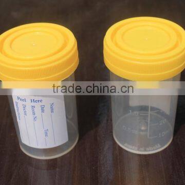disposable security screw cap pp hospital urine container 60ml wholesale