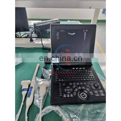 HC-A013C Factory Direct Portable 3D Color Doppler Ultrasound Machine 12 Inch LCD Display Laptop Ultrasound Diagnostic System photo-4