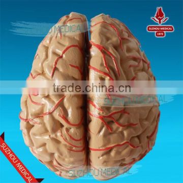 Distribution of brain and cerebral arteries