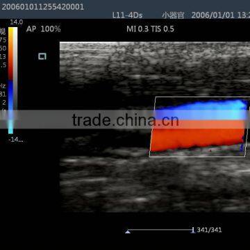 Laptop Color Doppler Ultrasound Syatem With Transducers photo-4