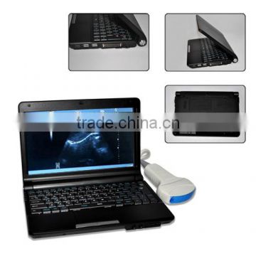 Laptop Ultrasound Scanner RUS-9000F Optional probe like Convex linear micro convex rectal Sony video thermal recorder