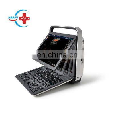 Portable Advanced 3D 4D Color Doppler Ultrasound Device Sonoscape S8 EXP Medical Ultrasound System Price