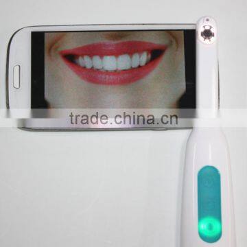 Medical Dental Products Intra-oral Camera New Products High Quality Oral Camera Usb Camera Original Medical Devices photo-5