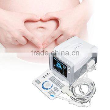 CE Approved Full Digital LCD Display Diagnostic Laptop Ultrasound Scanner photo-4