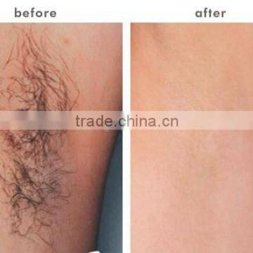 Tattoo Removal System 2016 Latest Professional Multifunctional Ipl Shr Laser System Pigmented Lesions Treatment Nd Yag Laser Hair And Tattoo Removal Beauty Machine photo-5