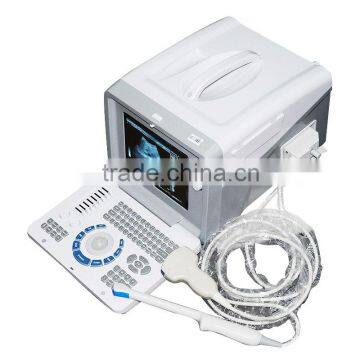 Portable Ultrasound Scanner Ultrasonic Diagnostic Machine System RUS-6000D With 3.5MHz Convex Probe Factory photo-4